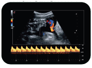 COLOR AND DOPPLER HIGH SENSITIVITY