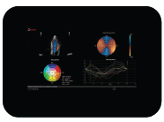 XSTRAIN4D